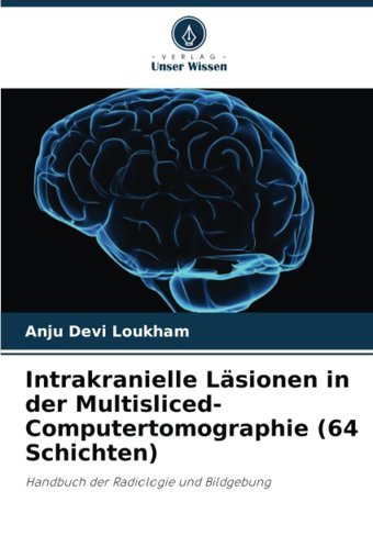 Intrakranielle Lsionen İn Der Multisliced-Computertomographie (64 Schichten): Handbuch Der Radiologie Und Bildgebung Loukham, Anju Devi Verlag Unser Wissen