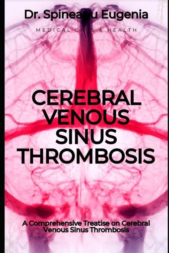 A Comprehensive Treatise On Cerebral Venous Sinus Thrombosis Eugenia, Dr. Spineanu Independently Publıshed