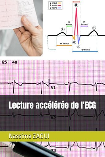 Lecture Acclre De L'Ecg Zaouı, Prof Nassime Independently Publıshed