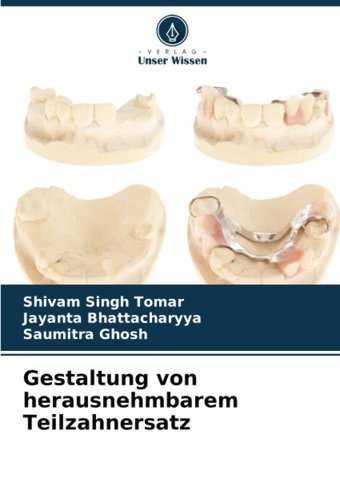 Gestaltung Von Herausnehmbarem Teilzahnersatz: De Tomar, Shivam Singh Verlag Unser Wissen