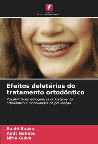 Efeitos Deletrios Do Tratamento Ortodntico Rauka, Rashi Edicoes Nosso Conhecimento