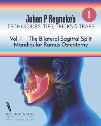 Johan P Reyneke'S Techniques, Tips, Tricks And Traps: Volume 1: The Bilateral Sagittal Split Mandibular Ramus Osteotomy Reyneke, Johan P