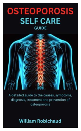Osteoporosıs Self Care Guıde: A Detailed Guide To The Causes, Symptoms, Diagnosis, Treatment And Prevention Of Osteoporosis Robichaud, William Independently Publıshed