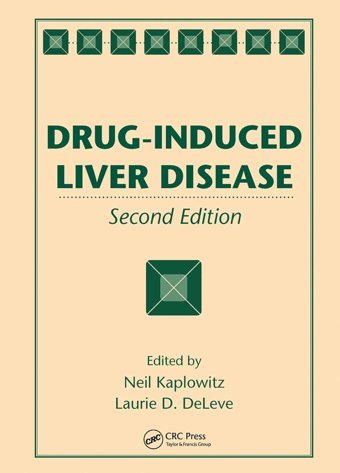 Drug-İnduced Liver Disease Kaplowitz, Neil Crc Press Inc