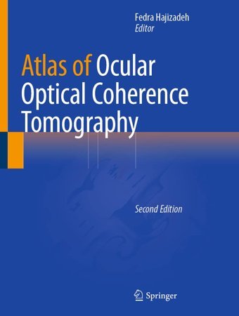 Atlas Of Ocular Optical Coherence Tomography Springer