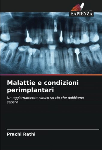 Malattie E Condizioni Perimplantari: Un Aggiornamento Clinico Su Ci Che Dobbiamo Sapere Rathi, Prachi Edizioni Sapienza