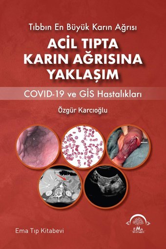 Acil Tıpta Karın Ağrısına Yaklaşım: Tıbbın En Büyük Karın Ağrısı Özgür Karcıoğlu Ema Tıp Kitabevi