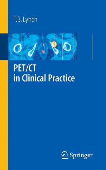 Pet/Ct İn Clinical Practice T. B. Lynch Springer