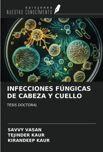 Infeccıones Fngıcas De Cabeza Y Cuello: Tesıs Doctoral Vasan, Savvy Ediciones Nuestro Conocimiento