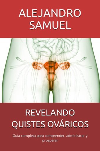 Revelando Quıstes Ovrıcos: Gua Completa Para Comprender, Administrar Y Prosperar (Spanish Edition) Samuel, Alejandro Independently Publıshed