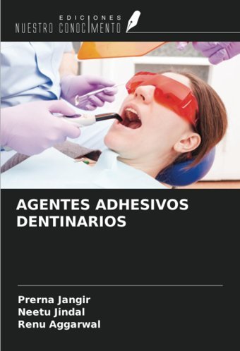 Agentes Adhesıvos Dentınarıos Jangir, Prerna Ediciones Nuestro Conocimiento