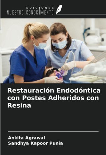 Restauracin Endodntica Con Postes Adheridos Con Resina Agrawal, Ankıta Ediciones Nuestro Conocimiento