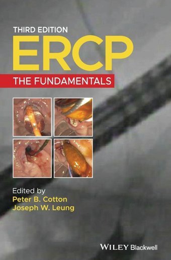 Ercp: The Fundamentals Wiley-Blackwell