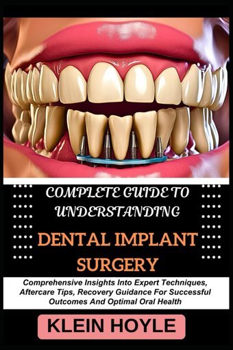 Complete Guıde To Understandıng Dental Implant Surgery: Comprehensive Insights Into Expert Techniques, Aftercare Tips, Recovery Guidance For Successful Outcomes And Optimal Oral Health Hoyle, Kleın Independently Publıshed