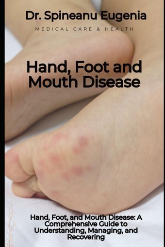 Hand, Foot, And Mouth Disease: A Comprehensive Guide To Understanding, Managing, And Recovering From Hfmd Eugenia, Dr. Spineanu Independently Publıshed