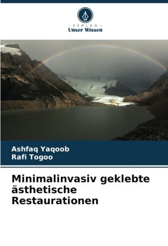 Minimalinvasiv Geklebte Sthetische Restaurationen: De Yaqoob, Ashfaq Verlag Unser Wissen