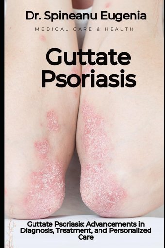 Guttate Psoriasis: Advancements İn Diagnosis, Treatment, And Personalized Care Eugenia, Dr. Spineanu Independently Publıshed