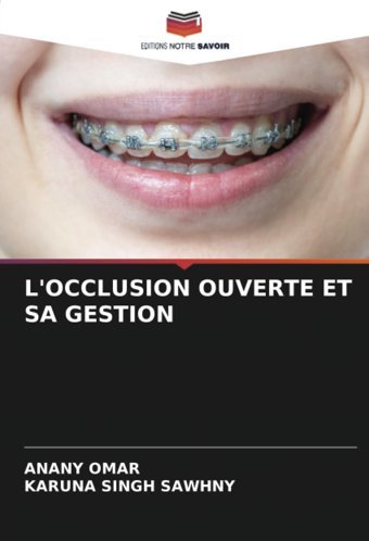 L'Occlusıon Ouverte Et Sa Gestıon: De Omar, Anany Editions Notre Savoir