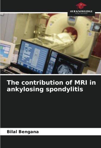 The Contribution Of Mrı İn Ankylosing Spondylitis Bengana, Bilal Our Knowledge Publishing