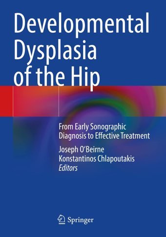 Developmental Dysplasia Of The Hip: From Early Sonographic Diagnosis To Effective Treatment Springer