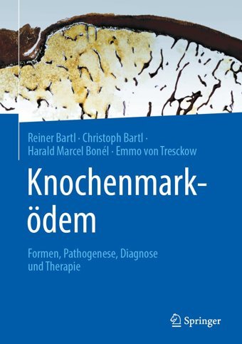 Knochenmarködem: Fortschritte İn Diagnostik Und Therapie Bartl, Reiner Springer