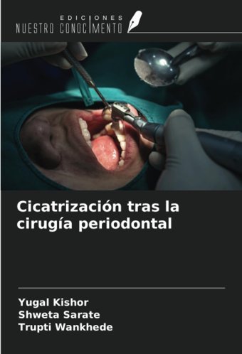 Cicatrizacin Tras La Ciruga Periodontal Kıshor, Yugal Ediciones Nuestro Conocimiento