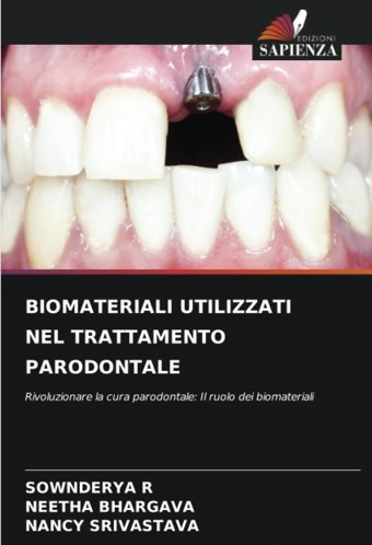 Bıomaterıalı Utılızzatı Nel Trattamento Parodontale: Rivoluzionare La Cura Parodontale: Il Ruolo Dei Biomateriali R, Sownderya Edizioni Sapienza