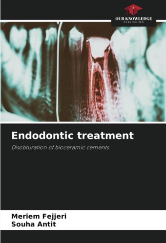 Endodontic Treatment: Disobturation Of Bioceramic Cements Fejjeri, Meriem Our Knowledge Publishing