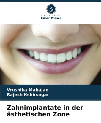 Zahnimplantate İn Der Sthetischen Zone Mahajan, Vrushika Verlag Unser Wissen