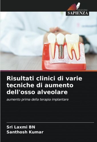 Risultati Clinici Di Varie Tecniche Di Aumento Dell'Osso Alveolare: Aumento Prima Della Terapia İmplantare Bn, Sri Laxmi Edizioni Sapienza