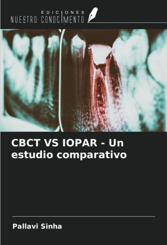 Cbct Vs Iopar Un Estudio Comparativo Sinha, Pallavi Ediciones Nuestro Conocimiento