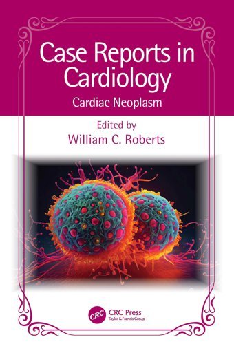Case Reports İn Cardiology: Cardiac Neoplasm Crc Press Inc