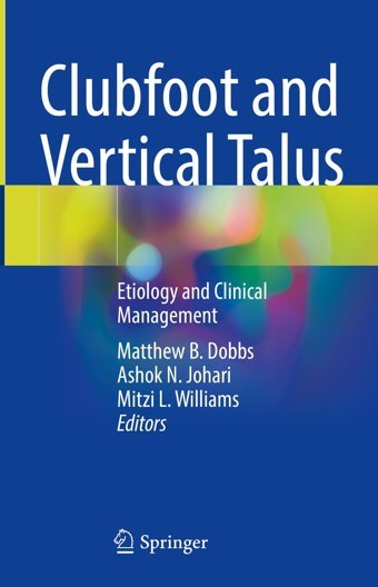 Clubfoot And Vertical Talus: Etiology And Clinical Management Springer