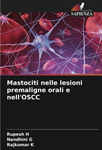 Mastociti Nelle Lesioni Premaligne Orali E Nell'Oscc H, Rupesh Edizioni Sapienza
