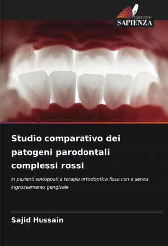 Studio Comparativo Dei Patogeni Parodontali Complessi Rossi: İn Pazienti Sottoposti A Terapia Ortodontica Fissa Con E Senza İngrossamento Gengivale Hussain, Sajid Edizioni Sapienza