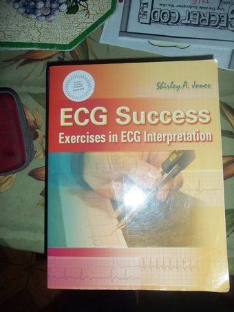 Ecg Success: Exercises İn Ecg Interpretation Shirley A. Jones F. A. Davis Company