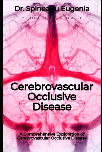 A Comprehensive Exploration Of Cerebrovascular Occlusive Disease Eugenia, Dr. Spineanu Independently Publıshed