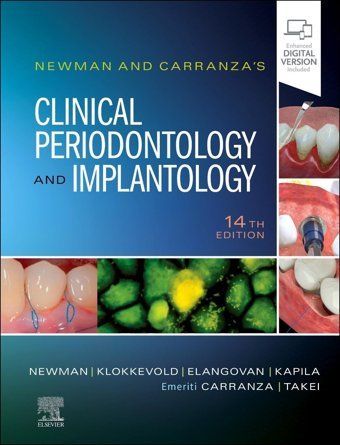 Newman And Carranza'S Clinical Periodontology And Implantology Newman, Michael G. Saunders