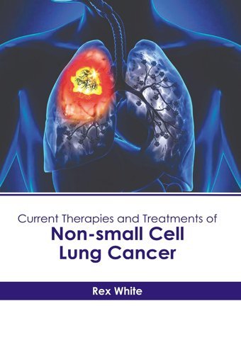 Current Therapies And Treatments Of Non-Small Cell Lung Cancer American Medical Publishers