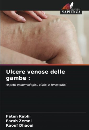 Ulcere Venose Delle Gambe :: Aspetti Epidemiologici, Clinici E Terapeutici Rabhi, Faten Edizioni Sapienza