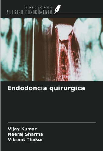 Endodoncia Quirurgica Kumar, Vijay Ediciones Nuestro Conocimiento