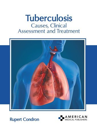 Tuberculosis: Causes, Clinical Assessment And Treatment American Medical Publishers