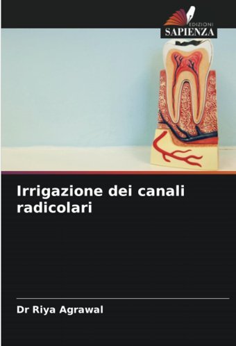 Irrigazione Dei Canali Radicolari Agrawal, Dr Riya Edizioni Sapienza
