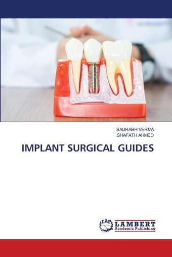 Implant Surgıcal Guıdes Verma, Saurabh Lap Lambert Academic Publishing