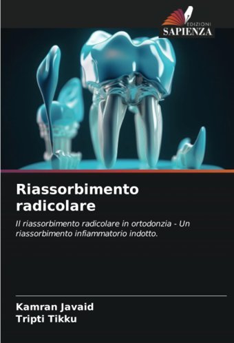 Riassorbimento Radicolare: Il Riassorbimento Radicolare İn Ortodonzia Un Riassorbimento İnfiammatorio İndotto. Javaid, Kamran Edizioni Sapienza