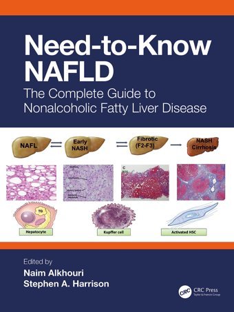 Need-To-Know Nafld: The Complete Guide To Non-Alcoholic Fatty Liver Disease Crc Press Inc
