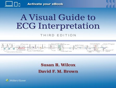 A Visual Guide To Ecg Interpretation: Print + Ebook With Multimedia Wilcox, Susan Renee Lippincott Williams And Wilkins