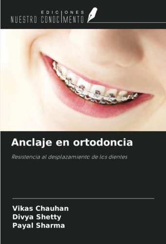 Anclaje En Ortodoncia: Resistencia Al Desplazamiento De Los Dientes Chauhan, Vikas Ediciones Nuestro Conocimiento