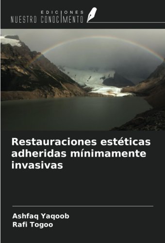Restauraciones Estticas Adheridas Mnimamente İnvasivas Yaqoob, Ashfaq Ediciones Nuestro Conocimiento
