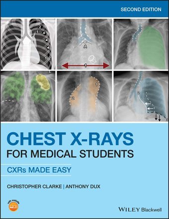 Chest Xrays For Medical Students: Cxrs Made Easy Clarke, Christopher Wiley-Blackwell